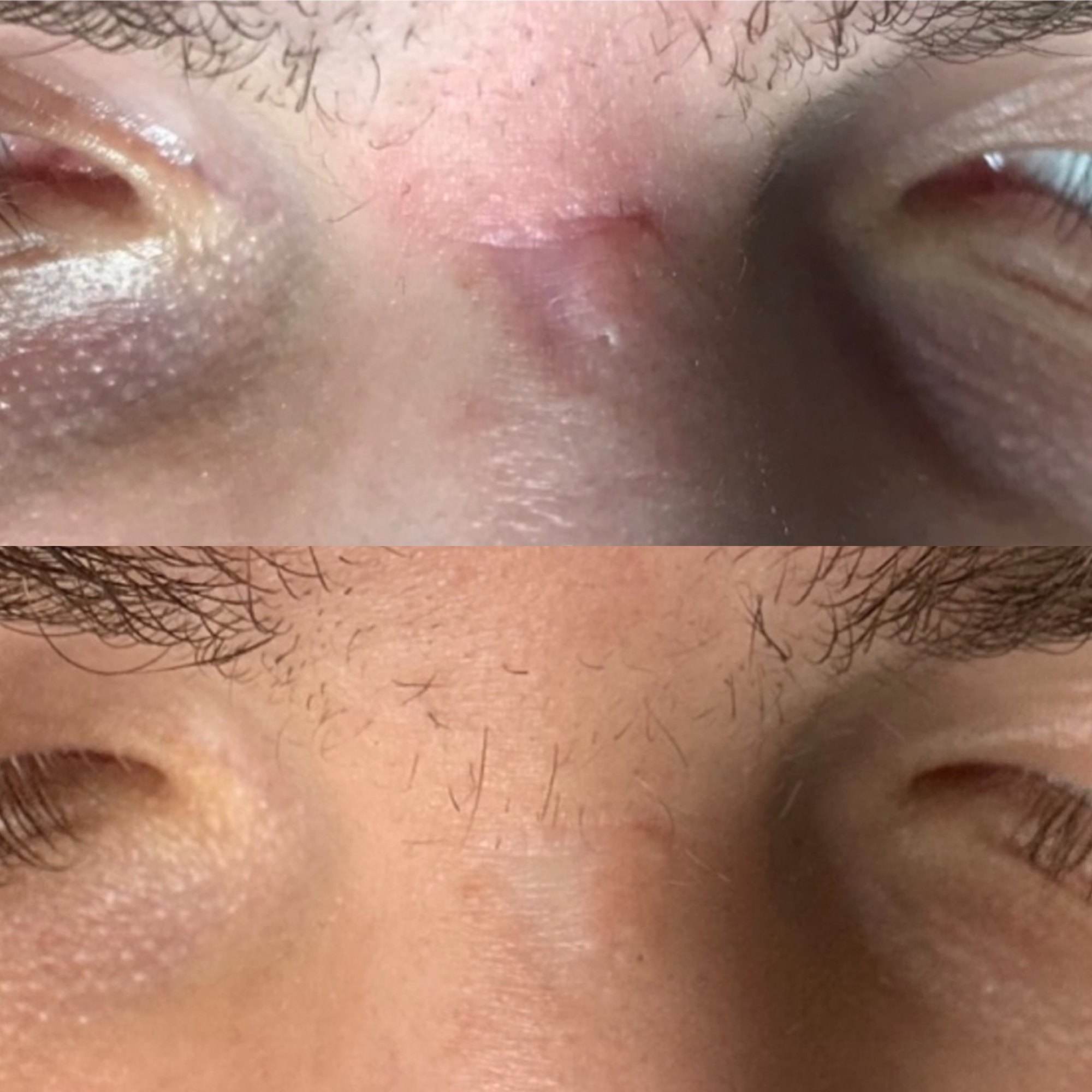 Skóra przed zabiegiem i po zabiegu, zdjęcie 7